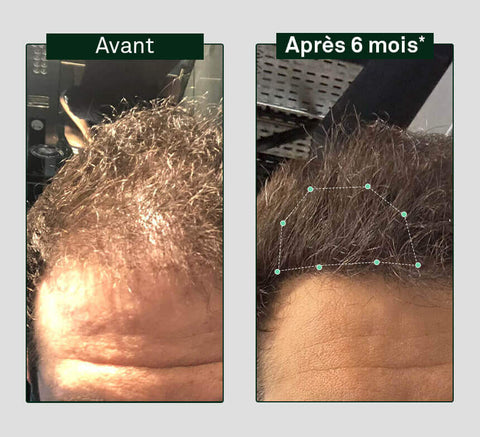 Hair Density Shampoo
